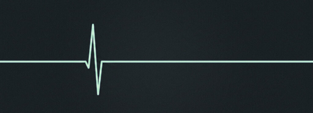 Illustration of a flat horizontal trace across a dark field, breaking once into a single sharp peak before continuing steadily