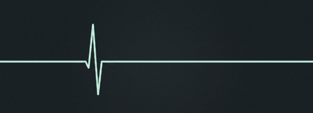 Illustration of a flat horizontal trace across a dark field, breaking once into a single sharp peak before continuing steadily